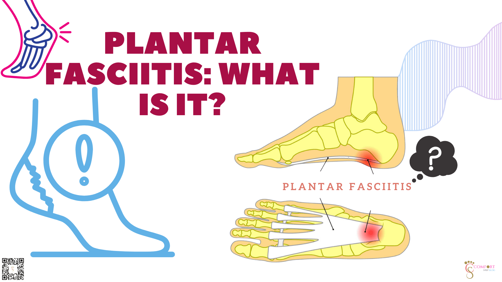 Plantar Fasciitis: What Is It?