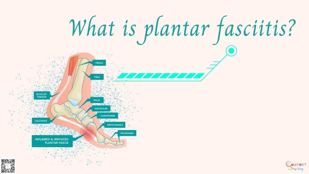 What is plantar fasciitis?